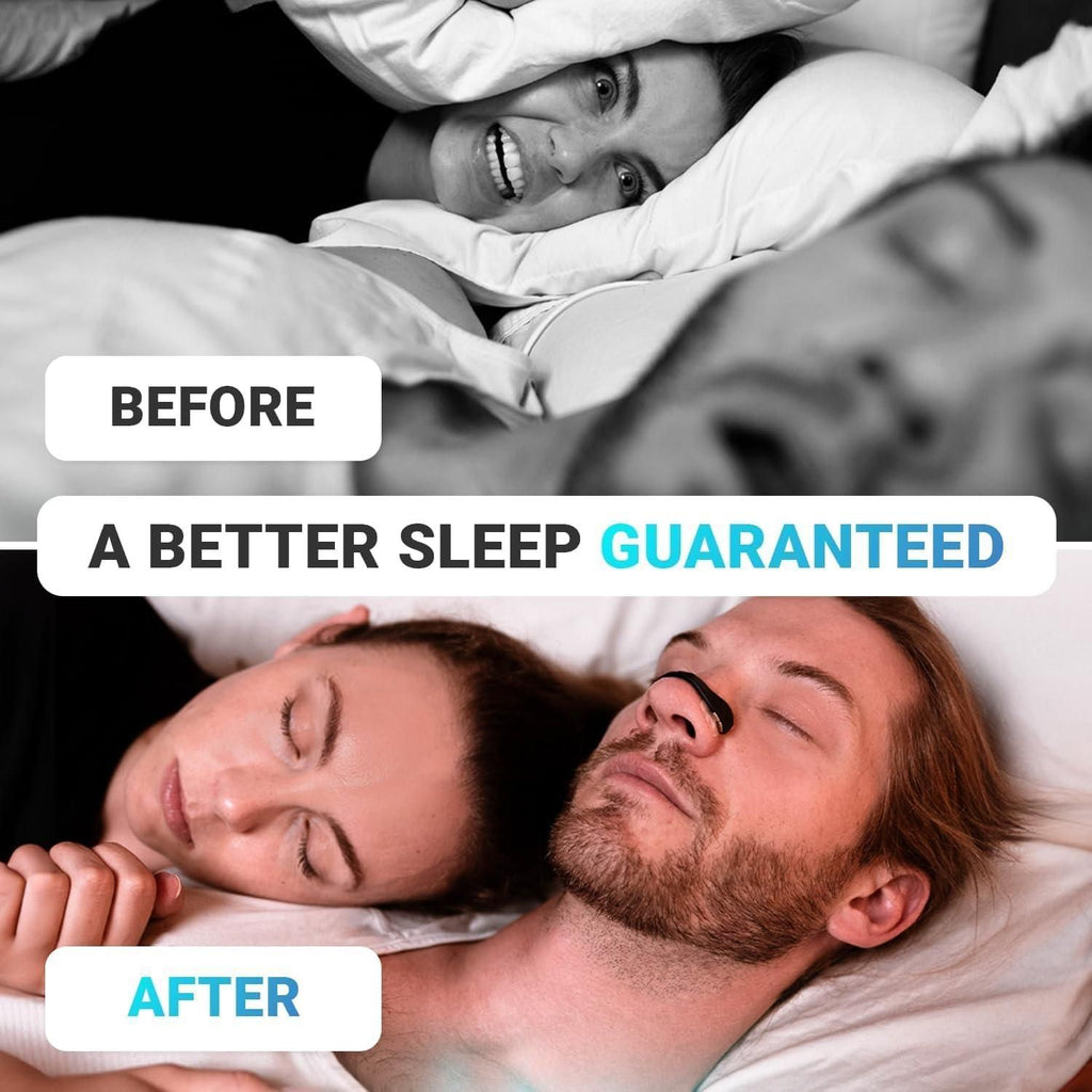 SnoreFree Nasal Breathing Strips – Sleep Better From Tonight